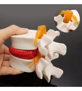 Fıtık Maket Disk Hernisi